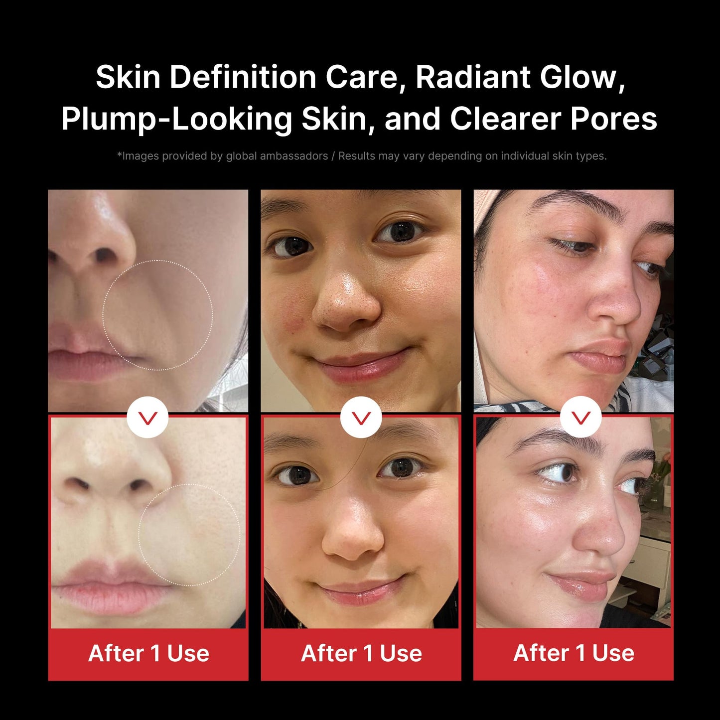 Medicube Age - R Booster Pro Pink | 6 - in - 1 Real Glass Annealing Device | Glass Skin with Improved Absorption. Shine. Elasticity. Pore Care | LED Skin Care Device | KoreanBiohackingMedicubeWellness Path HoldingB0CWK6YQ7VB0CWK6YQ7VMedicube Age - R Booster Pro Pink | 6 - in - 1 Real Glass Annealing Device | Glass Skin with Improved Absorption. Shine. Elasticity. Pore Care | LED Skin Care Device | Korean