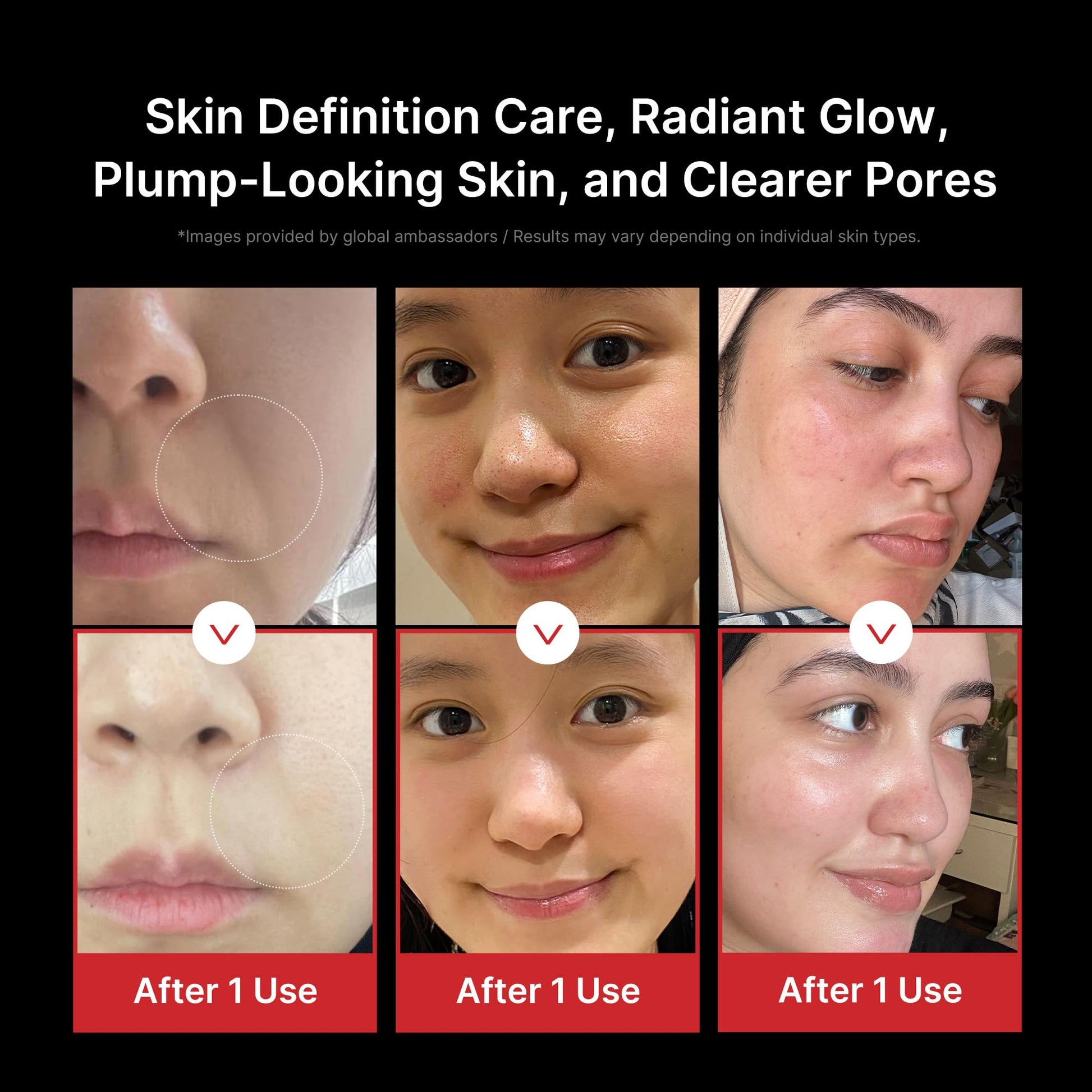 Medicube Age - R Booster Pro Pink | 6 - in - 1 Real Glass Annealing Device | Glass Skin with Improved Absorption. Shine. Elasticity. Pore Care | LED Skin Care Device | KoreanBiohackingMedicubeWellness Path HoldingB0CWK6YQ7VB0CWK6YQ7VMedicube Age - R Booster Pro Pink | 6 - in - 1 Real Glass Annealing Device | Glass Skin with Improved Absorption. Shine. Elasticity. Pore Care | LED Skin Care Device | Korean